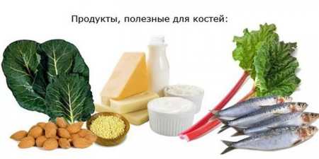 Харчування при переломах кісток рук для швидкого зрощення — корисні продукти