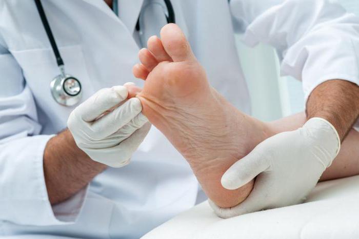 Як вилікувати грибок нігтів и стоп